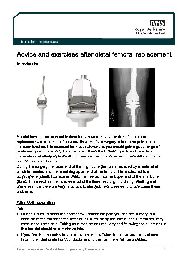 [PDF] Advice and exercises after distal femoral replacement