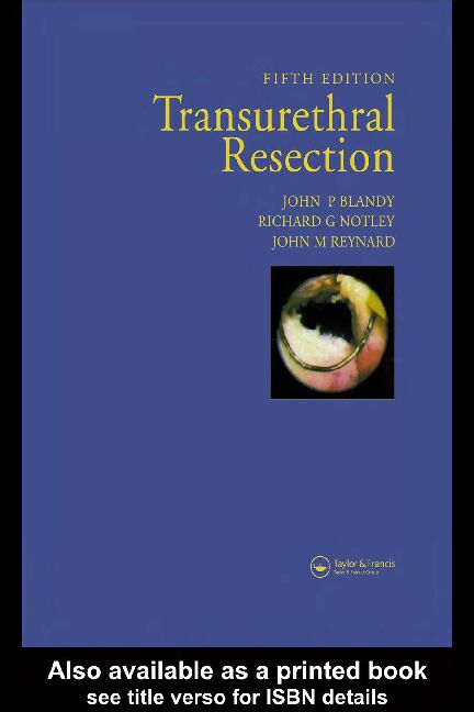 [PDF] TRANSURETHRAL RESECTION - British Association of Urological