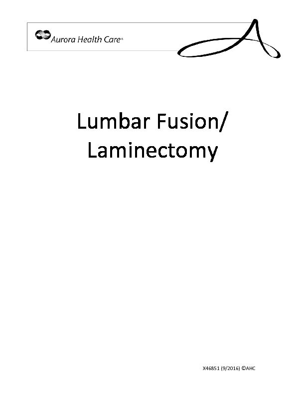 [PDF] Lumbar Fusion/ Laminectomy - Aurora Health Care