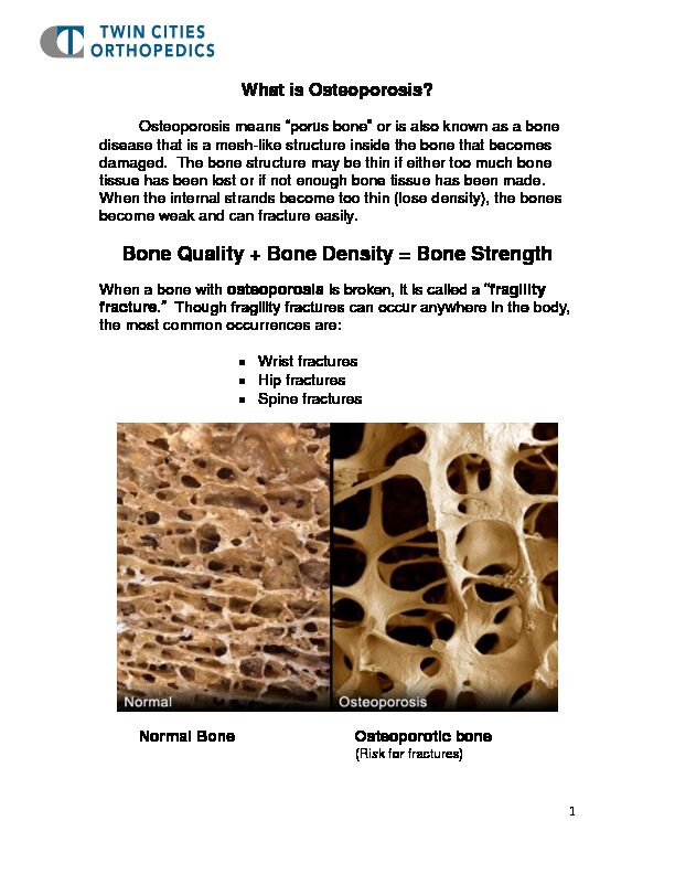 [PDF] Bone Quality   Bone Density = Bone Strength