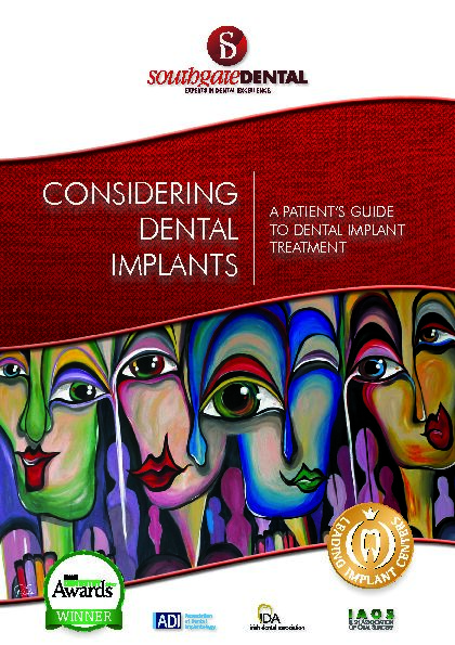 [PDF] CONSIDERING DENTAL IMPLANTS - Southgate Dental