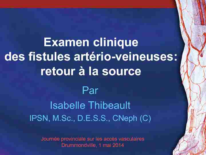 Examen clinique des fistules artério-veineuses: retour à la source
