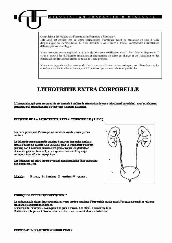 [PDF] LITHOTRITIE EXTRA CORPORELLE - HEGP