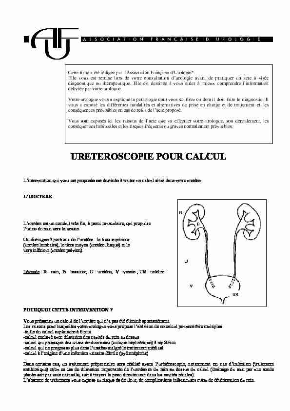 [PDF] URETEROSCOPIE POUR CALCUL - HEGP