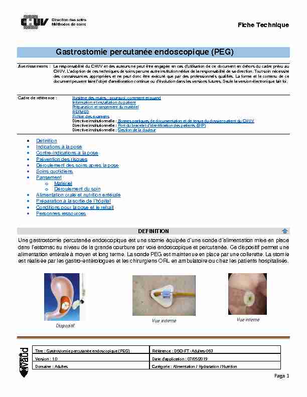 Gastrostomie percutanée endoscopique (PEG)