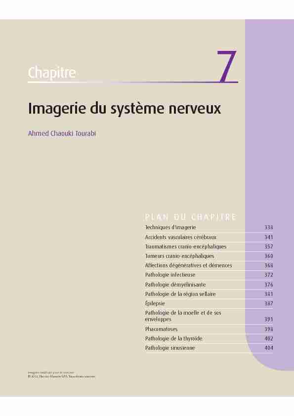 [PDF] Imagerie du système nerveux - EM consulte