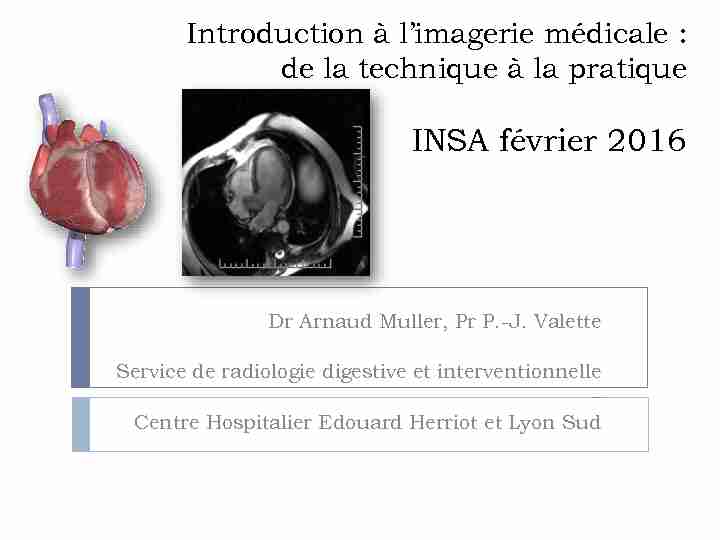 [PDF] Imagerie médicale - Moodle