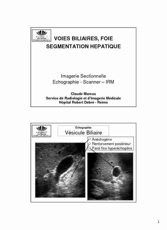 [PDF] VOIES BILIAIRES, FOIE SEGMENTATION HEPATIQUE Vésicule