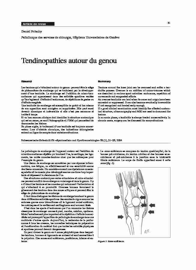 [PDF] Tendinopathies autour du genou - Sport & Exercise Medicine