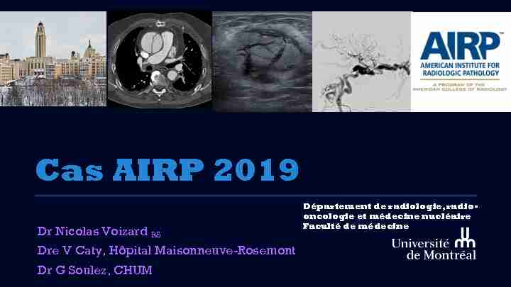 Cas AIRP 2019 - Département de radiologie radio-oncologie