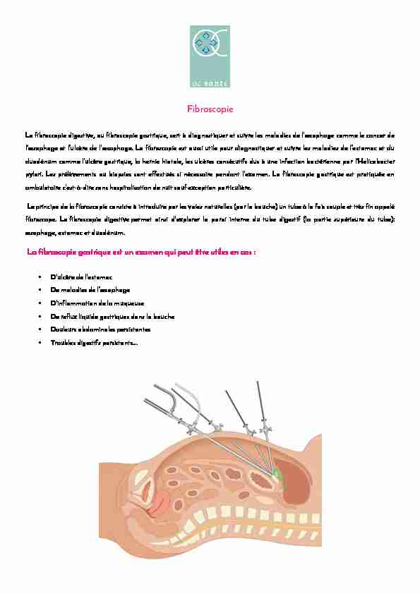 [PDF] Fibroscopie