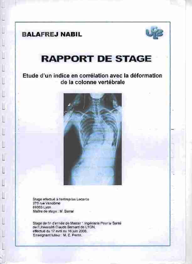 [PDF] RAPPORT DE STAGE - Centre Européen de la Colonne Vertébrale