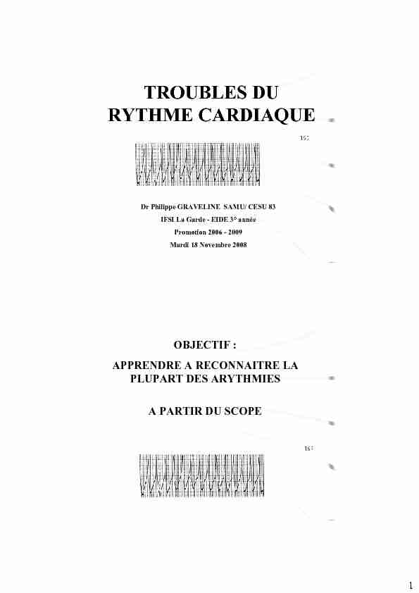 [PDF] TROUBLES DU RYTHME CARDIAQUE