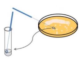 TP3 de microbiologie (L 2): Méthodes densemencement préparé