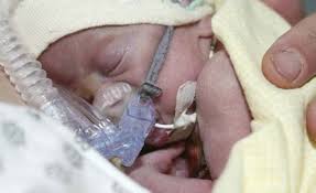 La détresse respiratoire du nouveau-né