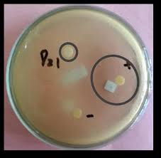 Antibacterial Activity of Buffalo Curd against Propionibacterium