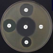 1 Spé-Thème 3A-Chapitre 16 : Variation génétique bactérienne et