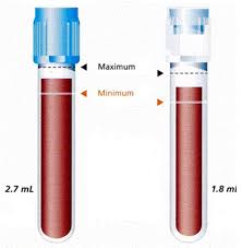 Ordre des tubes pour prélèvements sanguins veineux