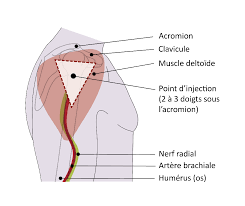 Technique dinjection intramusculaire (IM) pour la vaccination