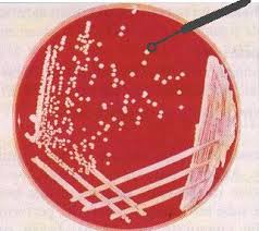 Module: Microbiologie TP4: Etude microscopique des bactéries