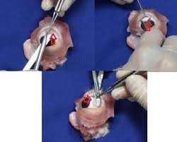 Anatomía quirúrgica del ojo: Revisión anatómica del ojo humano y